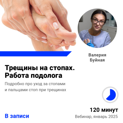 Запись вебинара Трещины на стопах. Работа подолога