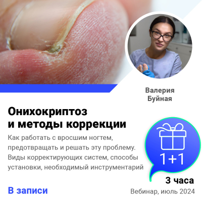 Запись вебинара Онихокриптоз и методы коррекции (2 часа)