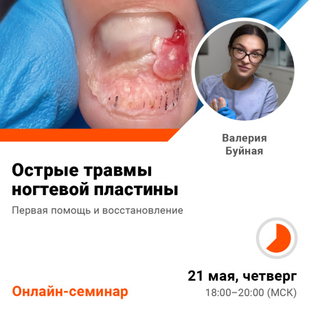 Острые травмы ногтевой пластины. Первая помощь и восстановление